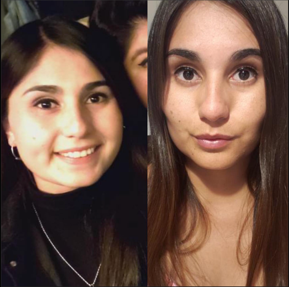 ¿Qué es el afinamiento facial?